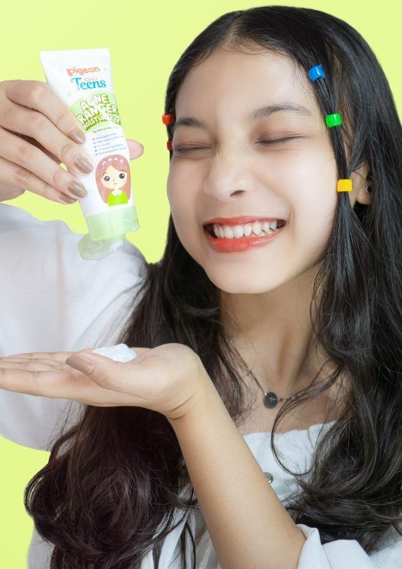 Wow Gak Perlu Khawatir Lagi Beraktivitas Diluar Ruangan, Ini Solusinya Untuk Melindungi Wajah Dari Paparan Sinar Matahari 16 , Sinar Matahari Pigeon Teens - Acne Ranger Moisturizer